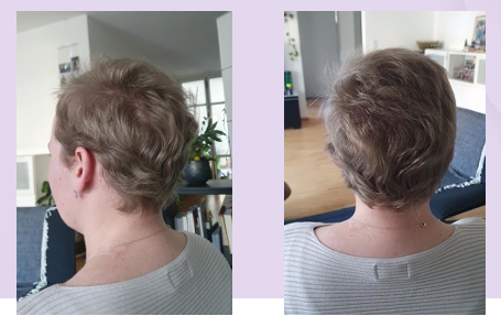 Erfahrungsbericht Chemo